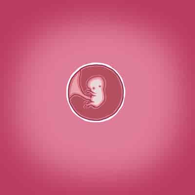 [Straw] Yumi's Study Abroad 由美的留学生活（汉化）（连载中）123