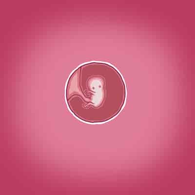 [Straw] Yumi's Study Abroad 由美的留学生活（汉化）（连载中）123