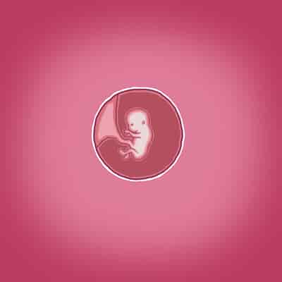 [Straw] Yumi's Study Abroad 由美的留学生活（汉化）（连载中）123